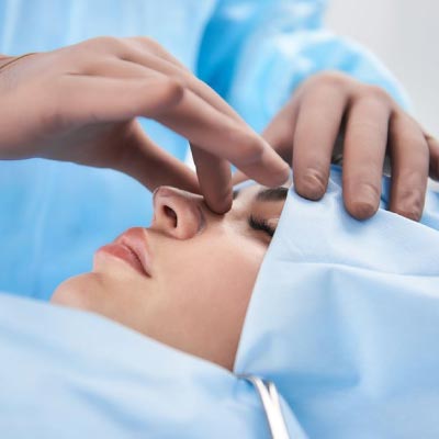 Turbinoplastia